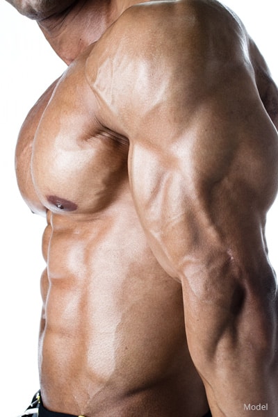 Bodybuilder + Steroid Use | San Francisco Bay Area | Miguel Delgado M.D.