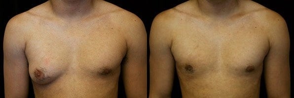 Before and after patient results 3